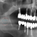 Group logo of All on 4 Dental Implants: Rediscover Your Smile with Confidence at Doctorprem